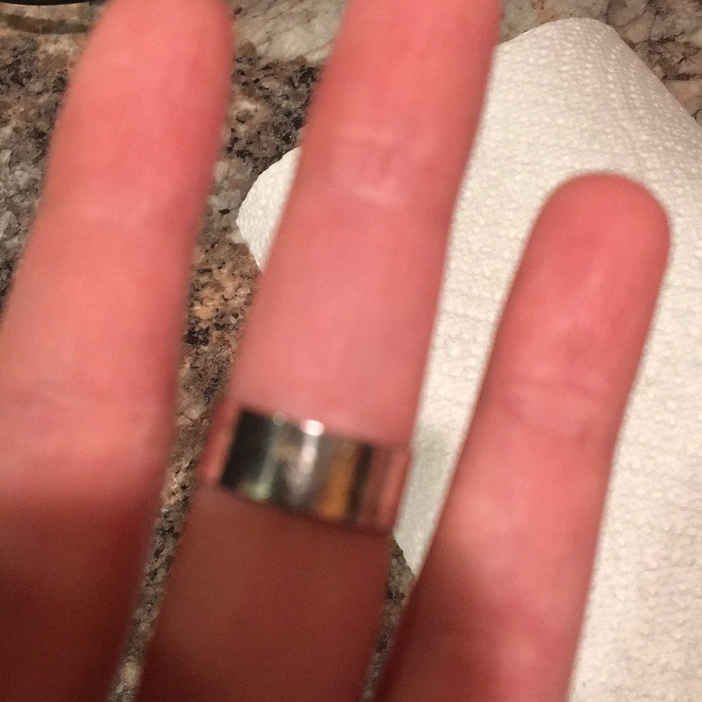 Button ring - Picture 2 of 2